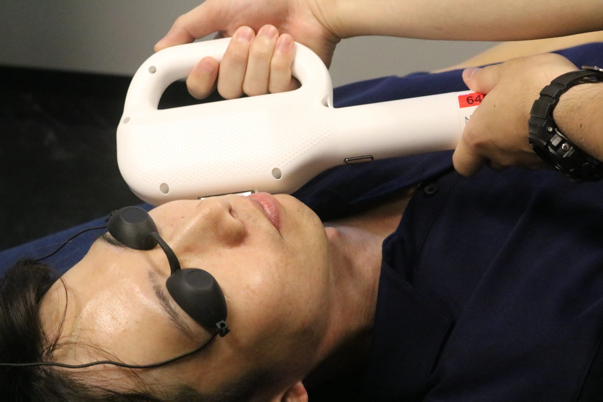 髭脱毛のすすめ！男の美意識を高める